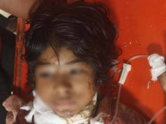 সীতাকুণ্ডের ইকোপার্কে গলা কাটা সেই শিশুটি মারা গেছে